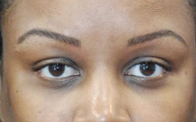 What is Micro Blading