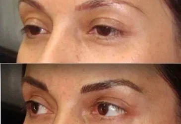 What to expect after a Permanent Makeup procedure