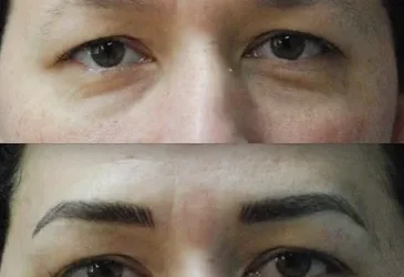 Men lose definition around their eyes with age