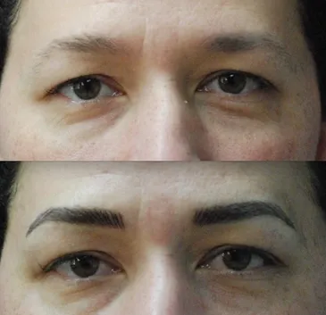 Medication and Permanent Makeup