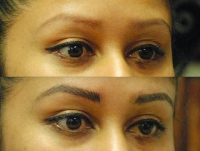 Tattoo Lightening vs. Tattoo Removal