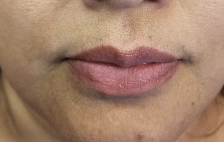 Is Lip Blushing tattoo painful?